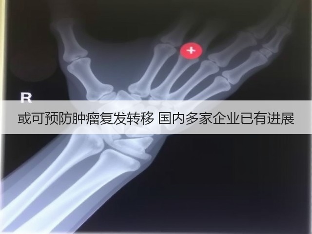 或可预防肿瘤复发转移 国内多家企业已有进展(图2) 或可预防肿瘤复发转移 国内多家企业已有进展(图2)
