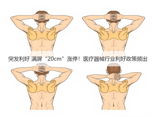 突发利好 满屏“20cm”涨停！医疗器械行业利好政策频出(图3)