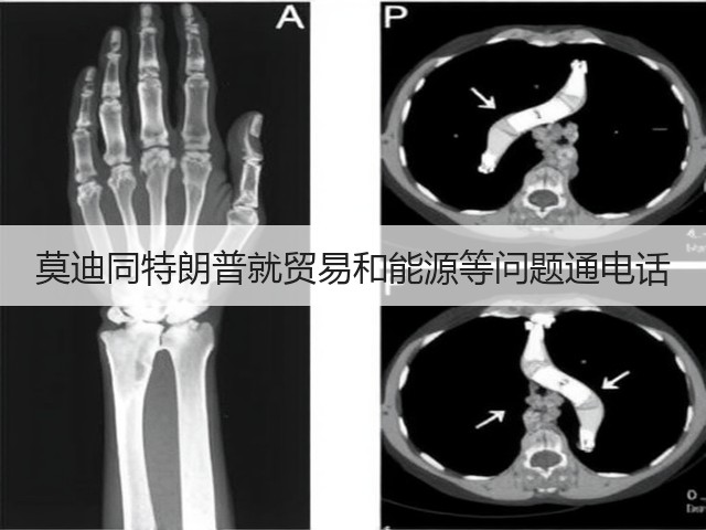 莫迪同特朗普就贸易和能源等问题通电话(图2)