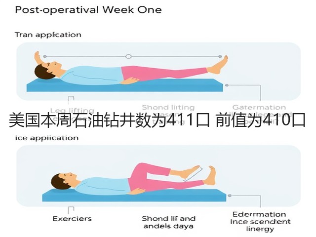 美国本周石油钻井数为411口 前值为410口(图1)