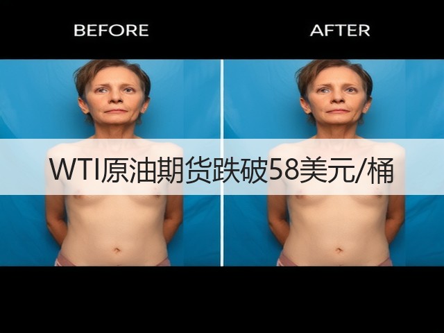 WTI原油期货跌破58美元/桶(图1)