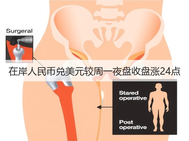 在岸人民币兑美元较周一夜盘收盘涨24点(图3)