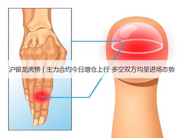 沪银龙虎榜 | 主力合约今日增仓上行 多空双方均呈进场态势(图3)