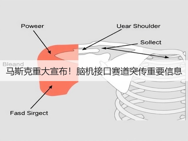 马斯克重大宣布!脑机接口赛道突传重要信息(图1) 马斯克重大宣布!脑机接口赛道突传重要信息(图1)