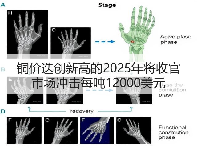 铜价迭创新高的2025年将收官 市场冲击每吨12000美元(图1)